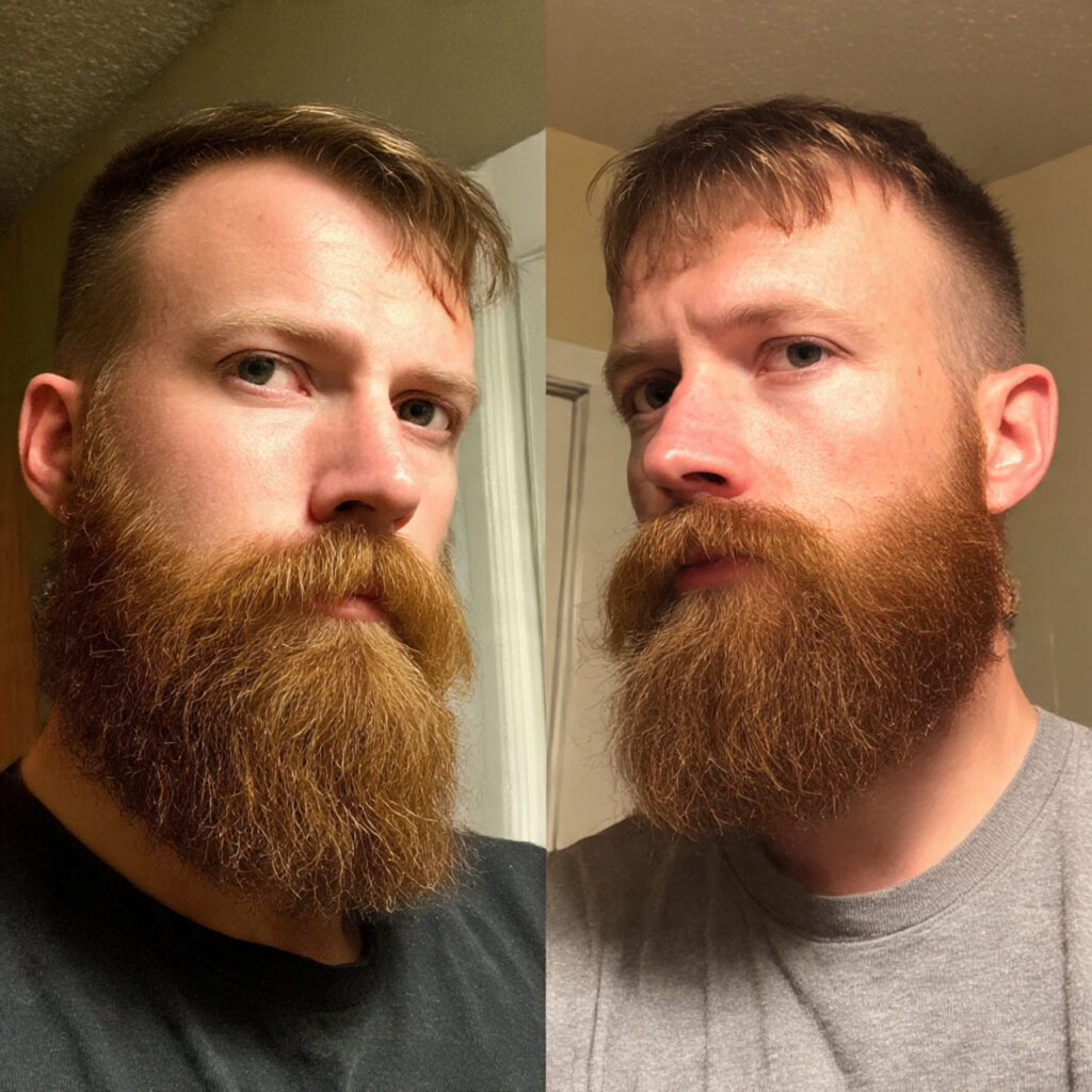 the anchor beard beard style to hide the anchor beard beard style to hide